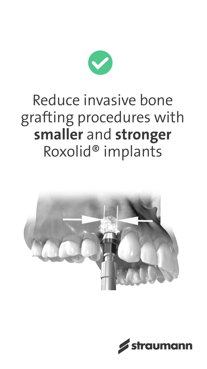 Roxolid® reducing bone grafting procedures